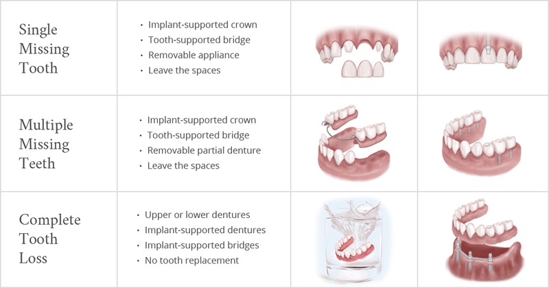 treatment options